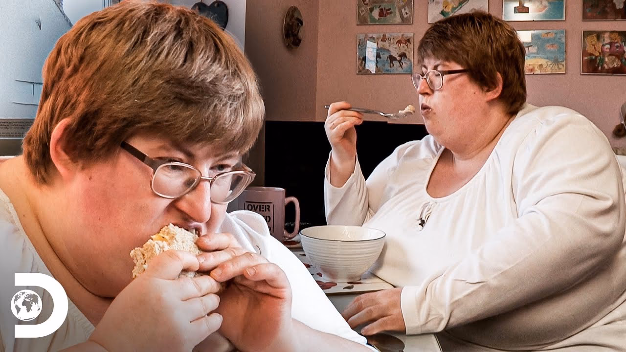 ¿Cuáles son los síntomas del síndrome de Prader Willi?